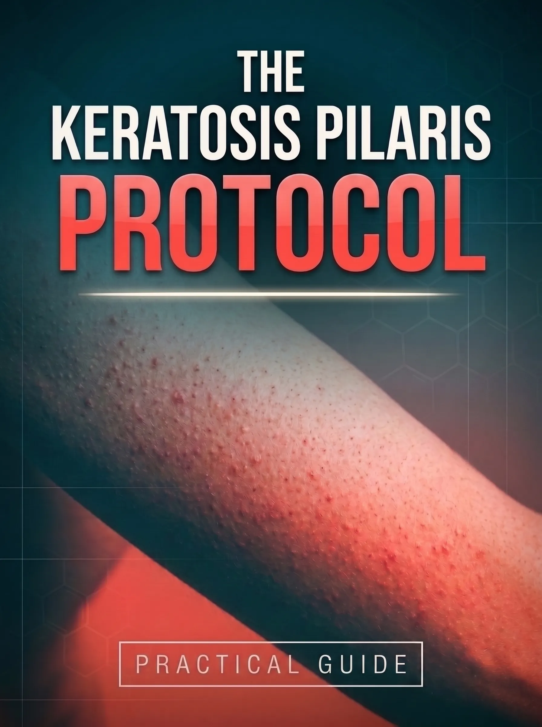 The Keratosis Pilaris Protocol: Practical Guide book cover
